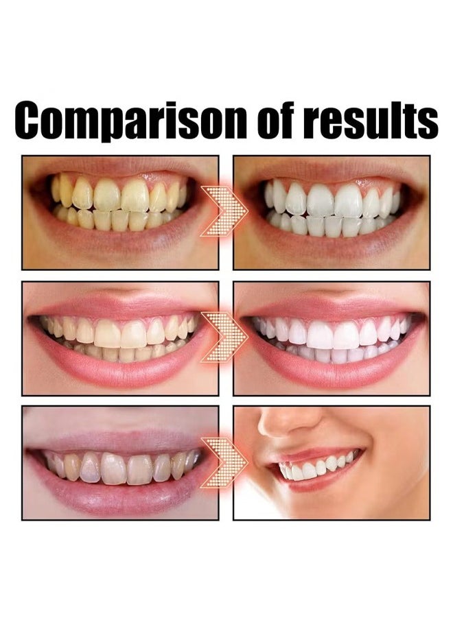SP Sp-6 Ultra Whitening Toothpaste, Sp-6 Probiotics Whitening Toothpaste, MS DRWIKEY Probiotics Bright White Toothpaste, Msdrwikey Sp-6 Toothpaste Oral Health Management, Fresh Breath (Red)  - Image 5
