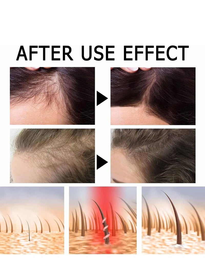 EELHOE Hair Strength Pro Ampoules , Hair-Regrowth Ampoules, Hair Growth Serum, Hair Growth Serum Biotin, Liascy Anti Thinning Treatment,Hair Loss Thickening Regrowth for Thinning Hair (2ml*7pcs) - Image 2