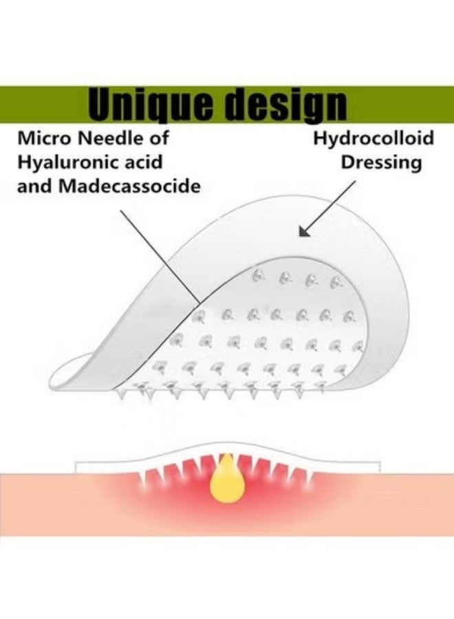 حياة مجنونة 9PCS تصحيحات حب الشباب Microneedles ، تصحيحات حبوب الشباب الوجه العناية بالبشرة ، تصحيحات حب الشباب الغير مرئية ، إزالة المرحلة المبكرة / الخفية / المكشوفة ، البثور ، البثور - Image 2
