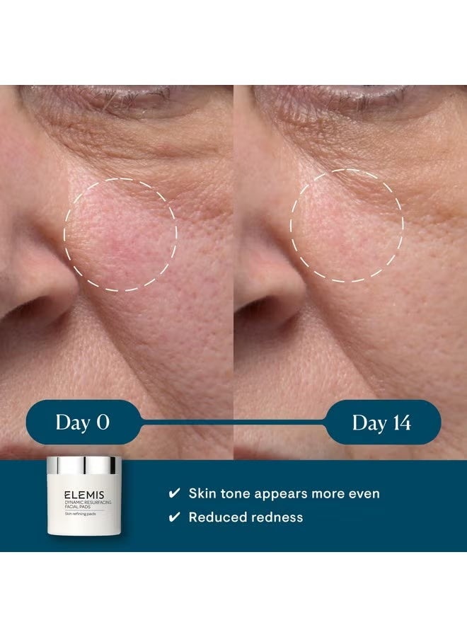 Elemis Dynamic Resurfacing Pads, Exfoliating Pads, Toner Pads, Chemical Exfoliant Face Toner, Lactic Acid Peel, Facial Cleansing Pads, Chemical Peel for Face - Image 2
