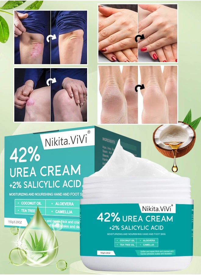NIKITA.VIVI 150g 42% Urea Cream Salicylic Acid Cream for Cracked Feet Hands Callus Remover Hand Cream Foot Cream for Cracked Foot Heels Elbows Nails Knees Skin Moisturizer Urea Lotion with Maximum Strength  - Image 1