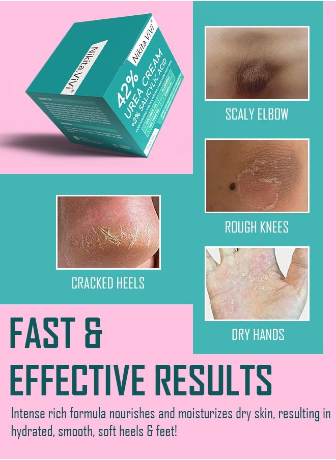 NIKITA.VIVI 150g 42% Urea Cream Salicylic Acid Cream for Cracked Feet Hands Callus Remover Hand Cream Foot Cream for Cracked Foot Heels Elbows Nails Knees Skin Moisturizer Urea Lotion with Maximum Strength  - Image 4