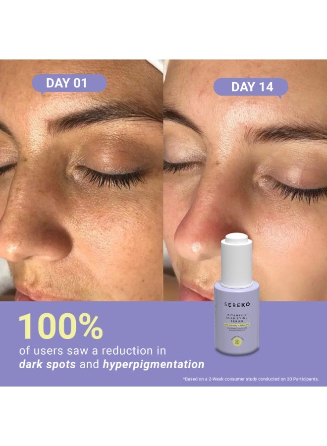 SEREKO Vitamin C Clarifying Serum | Face Serum for Glowing & Brightening Skin | Suitable to All Skin Types | Reduce Dark Spot, Recurring Acne & Blemishes | With Psychodermatology Formula | 30ml - Image 4