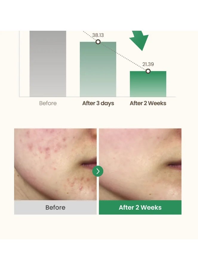 Glow Serum for Dark Spot Correction – Bright & Radiant Skin - Image 2