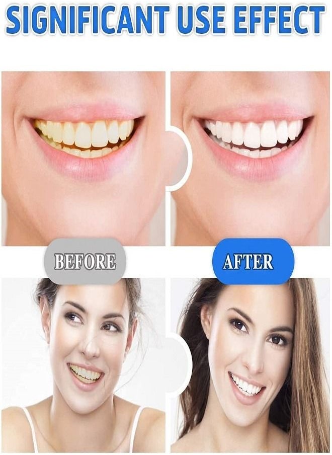 Generic - 5D Teeth Whitening Strips - 10-Pieces Teeth Whitening Strips - Image 1