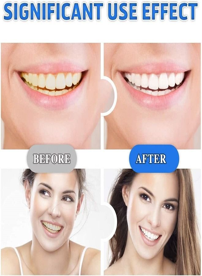 شرائح 5D لتبييض الأسنان - شرائط تبييض الأسنان - Image 4