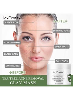JoyPretty Tea Tree Acne Removal Clay Mask - Blackheads & Acne Removal Tea Tree Clay Face Mask Minimize Pores Reduce Blackhead & Acne Anti-Aging Wrinkle Reduction Skincare with Tea Tree Face Mask 60g  - Image 3