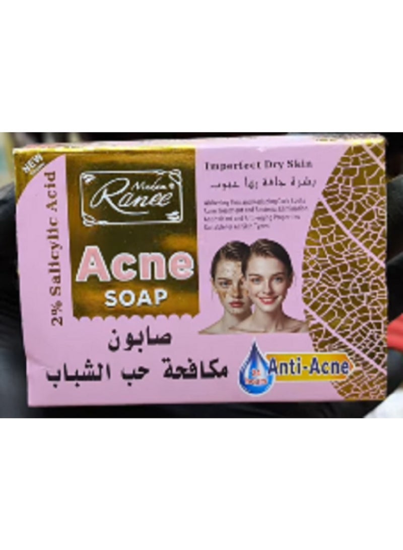 Madam Ranee anti-acne soap, which features 2% salicylic acid for treating acne and blackheads