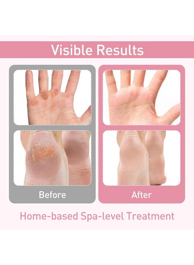 MAYCREATEÂ® 4 Pairs Silicone Moisturizing Glove Socks Set, Anti Slip Soft Spa Gel Socks Softening Feet Dry Cracked Skin, Women Spa Pedicure Socks for Foot Hand Softening, Foot Care After Pedicure - Image 5