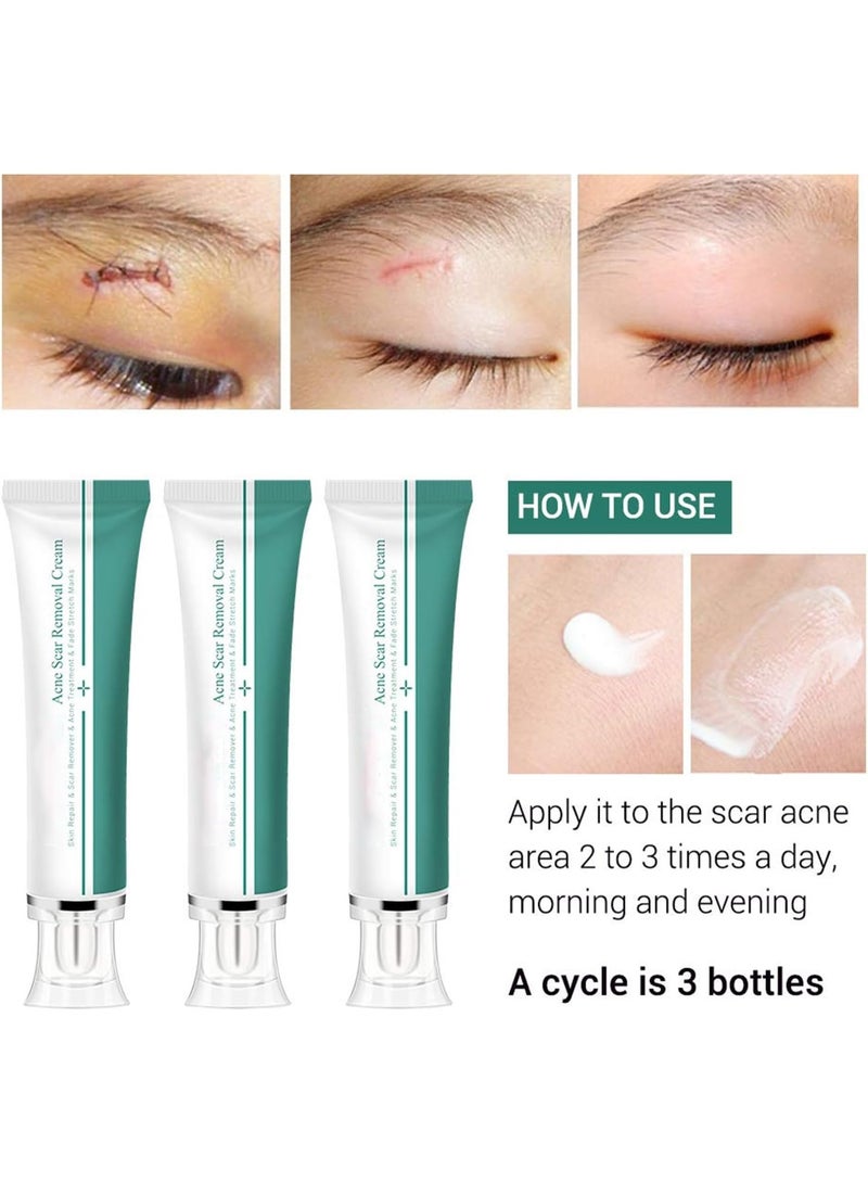 Breylee Acne Scar Removal Cream, Skin Repair & Stretch Mark Treatment - Image 3