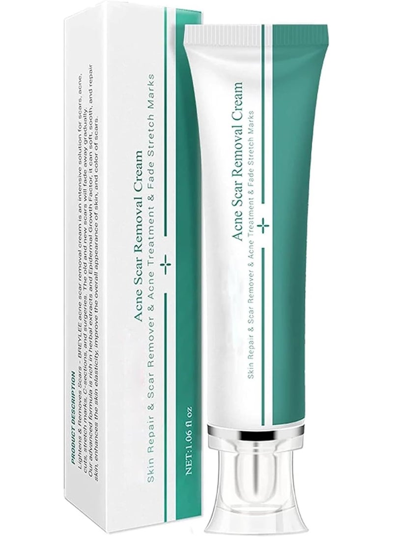 Breylee Acne Scar Removal Cream, Skin Repair & Stretch Mark Treatment - Image 2