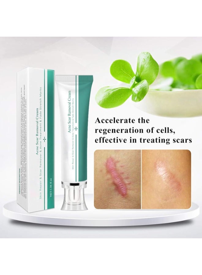Breylee Acne Scar Removal Cream, Skin Repair & Stretch Mark Treatment - Image 1
