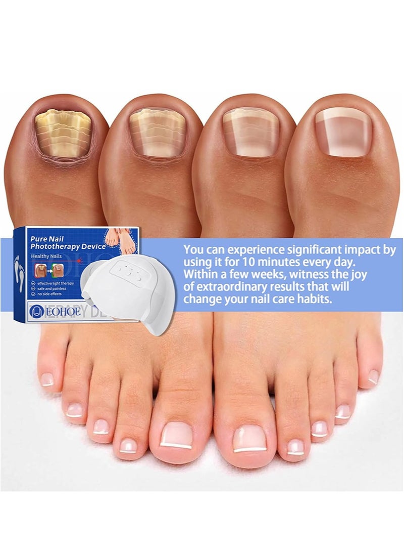 EOHOE Nail Fungus Cleaning Light Device for Multiple Toenail,Nail Fungus Treatment Device Nail Fungus Laser with 905nm Infrared Light + 470nm Blue Light for Fingernails and Toenails - Image 5