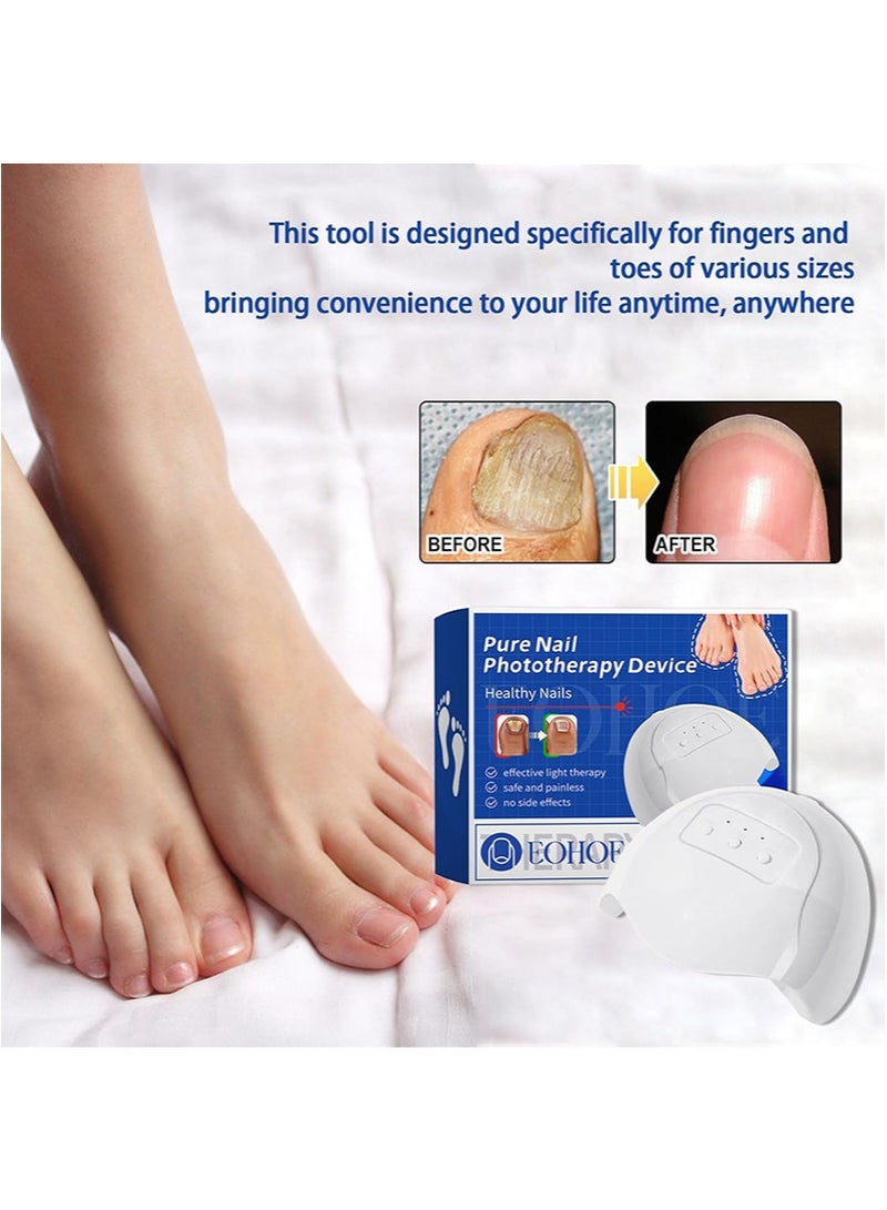 EOHOE Nail Fungus Cleaning Light Device for Multiple Toenail,Nail Fungus Treatment Device Nail Fungus Laser with 905nm Infrared Light + 470nm Blue Light for Fingernails and Toenails - Image 4