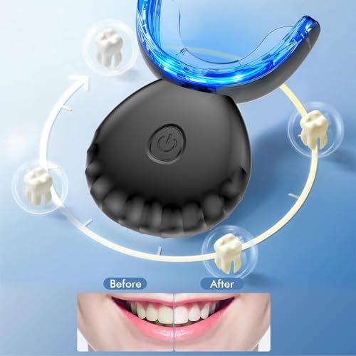 EOICCEOH Teeth Whitening Light10X More Powerful Blue Led Light Connected with USB NonBattery Teeth Whitening LED Light in Home Use Black - Image 5