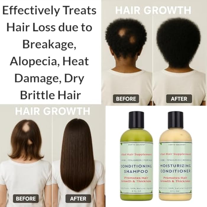 Moringa Rosemary Fenugreek Shea Butter Shampoo and Conditioner Set For Dry Brittle Hair Promotes Hair Growth & Thickness | Moringa Hair Butter Mega Hair Growth Shampoo & Conditioner - Image 2