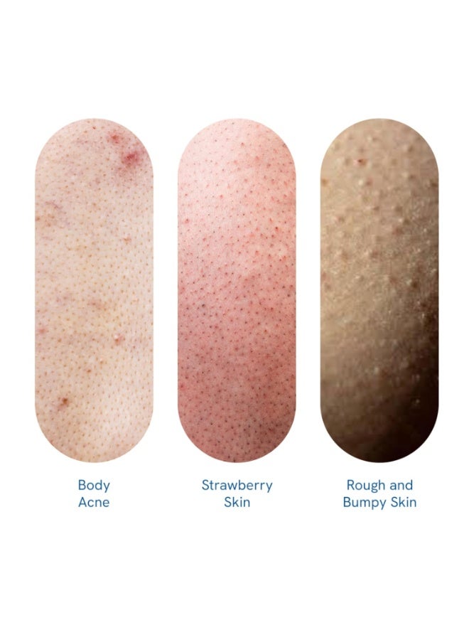 Bodywise 1% Salicylic Acid Body Wash 250ml - Image 5