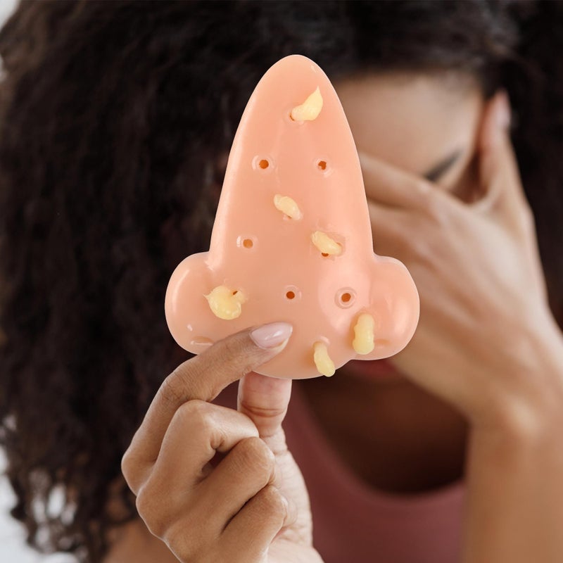 KH866 Pimple Popping Stress Relief Simulator â€“ Squeeze Nose Acne Blackhead Remover Popper with 30ml Filler Solution Tools, Reusable Self-Filling Gadget for Adults Teens, Weird Novelty Funny Anxiety Relief - Image 1