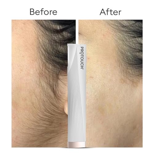 PROTOUCH Electric Dermaplaning Device | Beauty Tool | 2 in 1 Eyebrow & Face Hair Remover with Gentle Exfoliation | Quick, Painless, Smoother & Glowing Skin | 3 attachment | Easy & Safe to Use - Image 3