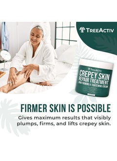 TreeActiv TreeActiv Crepey Skin Repair Treatment, 8oz, Firming Cream For Face and Neck, Skin Firming and Tightening Lotion with Hyaluronic Acid, Crepey Skin Treatment that Moisturizes Dry Crepe Skin, 500+ Uses  - Image 5