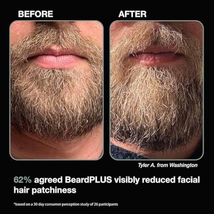 ZEUS BeardPLUS Shampoo for Men, Enhanced Beard Growth & Hair Care Treatment with Biotin & Caffeine to Boost Thickness, Strength, Hydration, and Skin Comfort (Made in USA) 6 oz. - Image 3