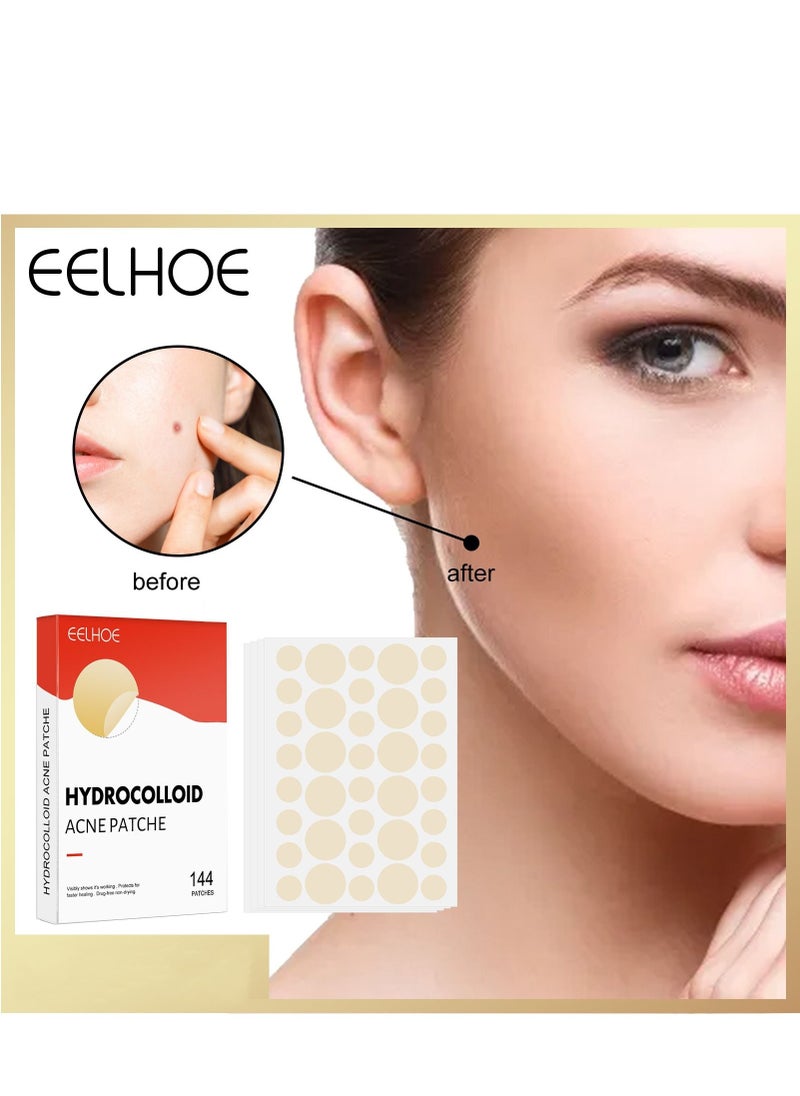 EELHOE Hydrocolloid Acne Patch Invisible Makeup Closed Acne Patch Net Acne Waterproof Breathable Acne Muscle Repair Patch  - Image 1