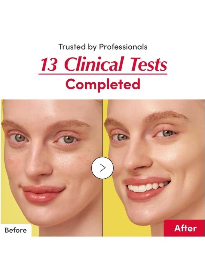 إيكوالبيري سيروم تفتيح البشرة مع فيتامين C: سيروم تفتيح البشرة مع أكيرولا ونياسيناميد، يعزز حاجز الجلد، يرطب بسيراميد وحمض الهيالورونيك 1.01 أونصة / 30 مل - Image 3