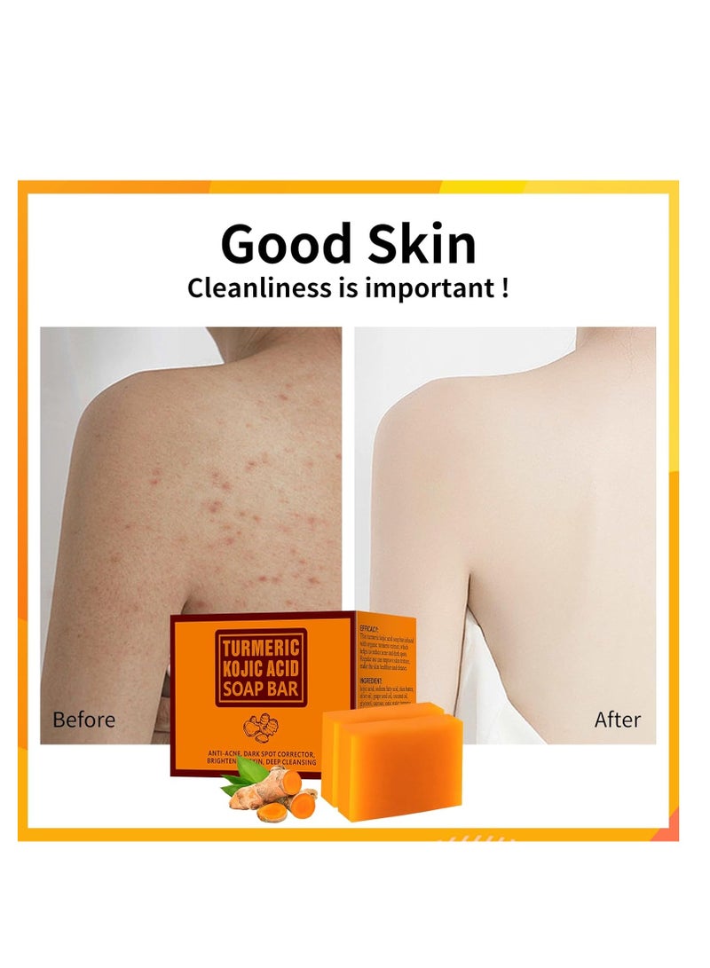 YAFUSIPE Koji Acid Soap for Dark Spots Turmeric Soap for Face and Body Kojic Acid Soap Skin Brightening Tumeric Soap for Acne Dark Spots Hand Soap Bar Acne Curcuma Soap for Blemishes Pimples Face Wash 200g/7OZ - Image 2