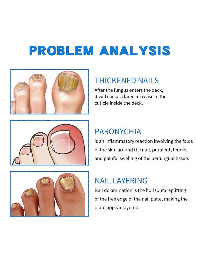 Sumifun Nail Repair Cream - Nail Toe Cream, Nail Cream Anti Harmful Substances Repair Finger Toe Nail Care Perfect for Men and Women Home Use - Image 3