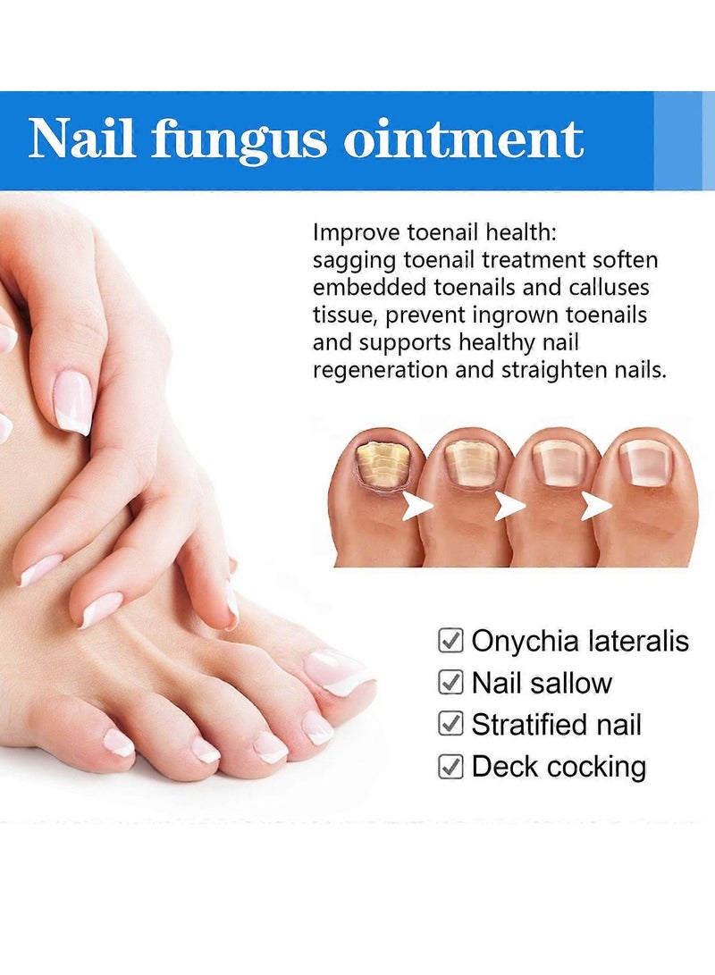 Sumifun Nail Repair Cream - Nail Toe Cream, Nail Cream Anti Harmful Substances Repair Finger Toe Nail Care Perfect for Men and Women Home Use - Image 4