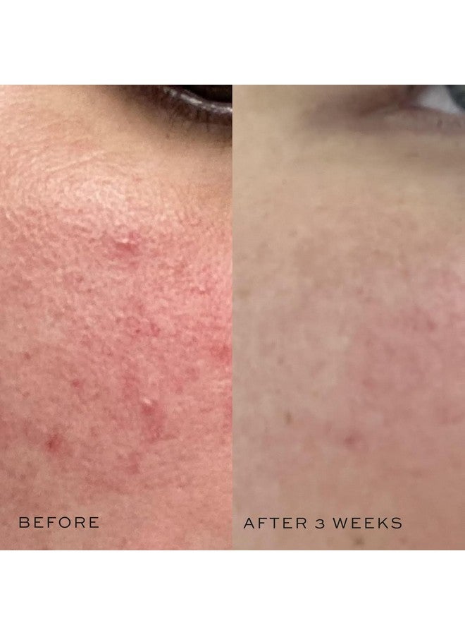 DIME Beauty Super Skin Toner, Alcohol-Free Witch Hazel Toner, Hydrating Toner for Face with Aloe Vera and Cucumber Extract, 4 oz / 120 ml - Image 4