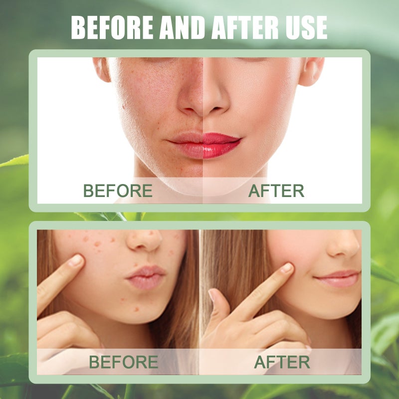 Ouhoe Green Tea Mask Stick Acne Blackhead Acne Facial Deep Cleansing Tight Pores Smear Type Mask Mud - Image 4