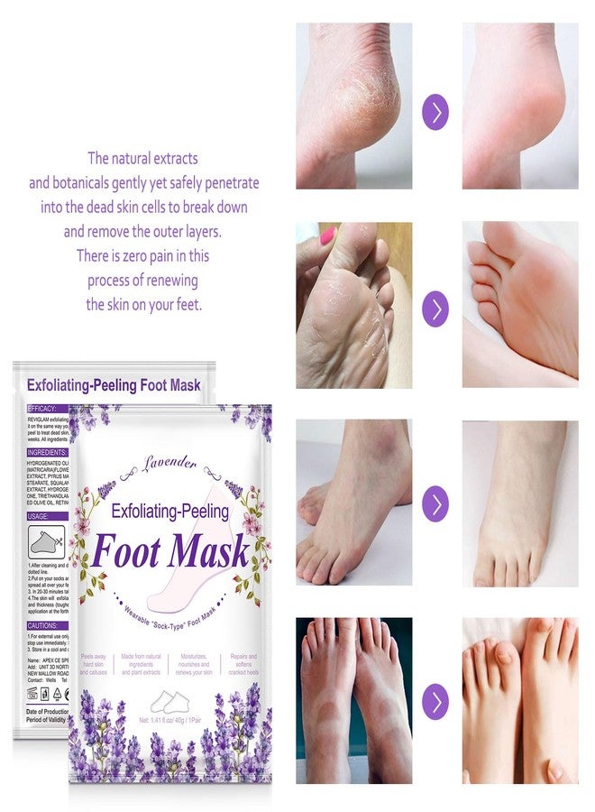 SOLOTREE Foot Peeling Mask, 2 Pack Peel Mask, Lavender Exfoliating Foot Peel Mask, Cracked Heels for Calluses, Dry Skin - Image 5