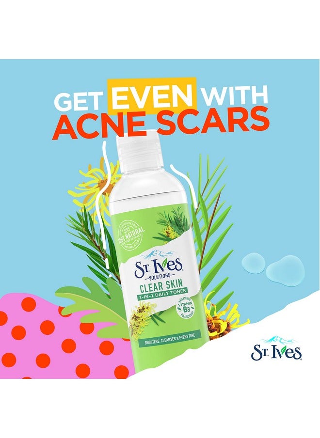 ST. Ives - St.Ives Solutions 3-In-1 Face Toner For Combination To Oily And Acne Prone Skin Clear Skin Made With 100 Percent Natural Tea Tree Extract, Vitamin B3, Micellar Water Technology, And Witch Hazel 8.5 Oz - Image 1