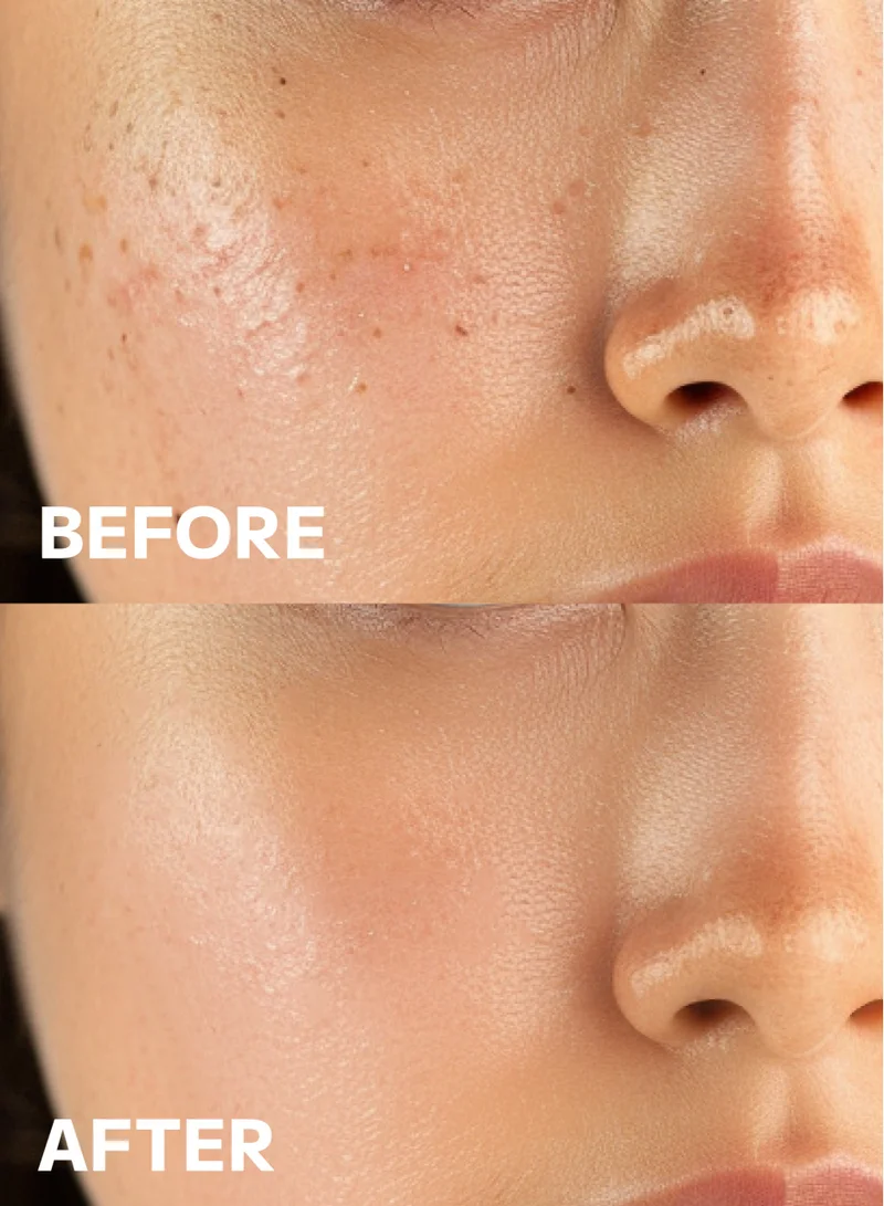 GSLEY Mild Mud Cleanser Korea Beauty - Deep Foam Pore Cleanser Gentle Exfoliator with Natural Cooling Soothing COMPLEX S