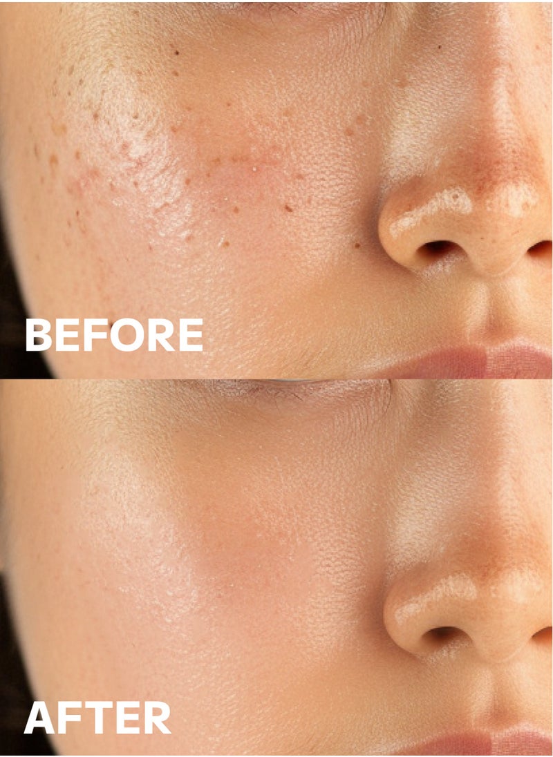 Mild Mud Cleanser Korea Beauty - Deep Foam Pore Cleanser Gentle Exfoliator with Natural Cooling Soothing COMPLEX S