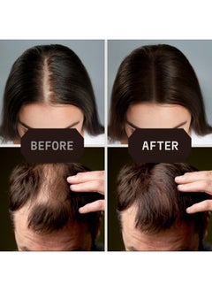 Striking Viking Hair Fibers For Thinning Hair Hair Building Fibers (Dark Brown) 28G Naturally Derived Formula Long Lasting Hair Powder For Undetectable Thicker Looking Hair For Men & Women  - Image 4