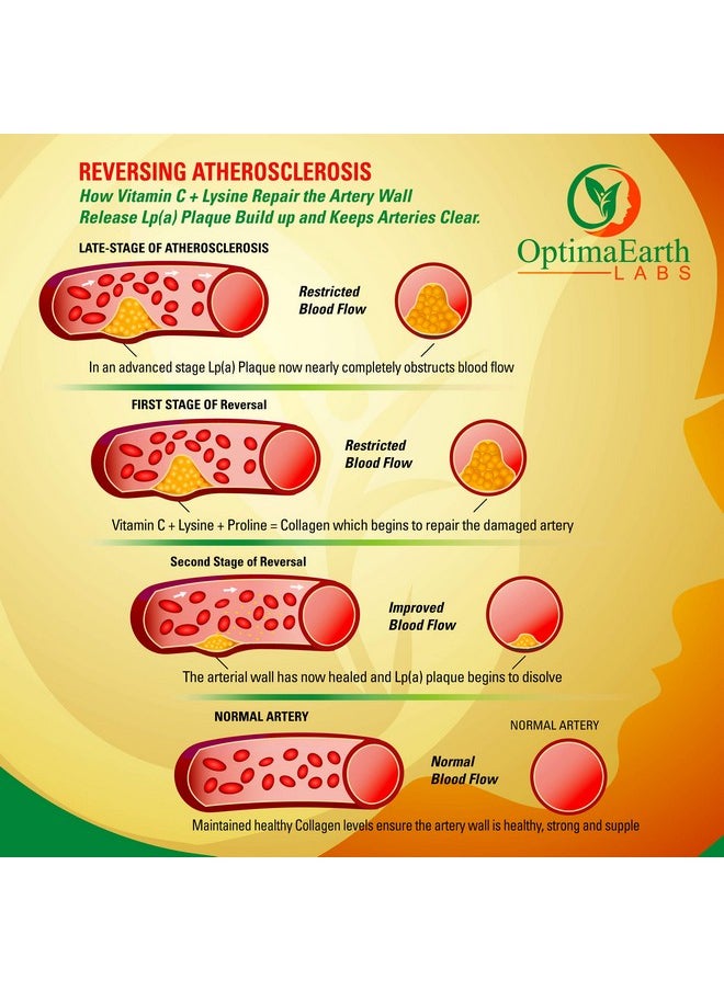 OptimaEarth Labs Eart Health Supplements Artery Cleanse Lower Cholesterol & Blood Pressure By Optimaearth Labs  - Image 5