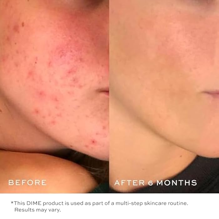 DIME Beauty Gentle Jelly Cleanser, Hydrating Facial Cleanser and Makeup Remover with Vitamin E, Sensitive Skin Face Wash, 4 oz / 120 ml - Image 4