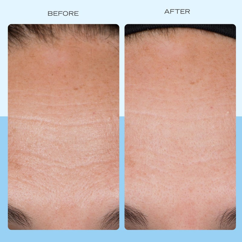 First Aid Beauty كريم الكولاجين لشد البشرة من فيرست إيد بيوتي مع الكولاجين والببتيدات والنياسيناميد - مرطب للوجه مضاد للشيخوخة ليلاً ونهارًا - 1.7 أونصة سائلة - Image 3