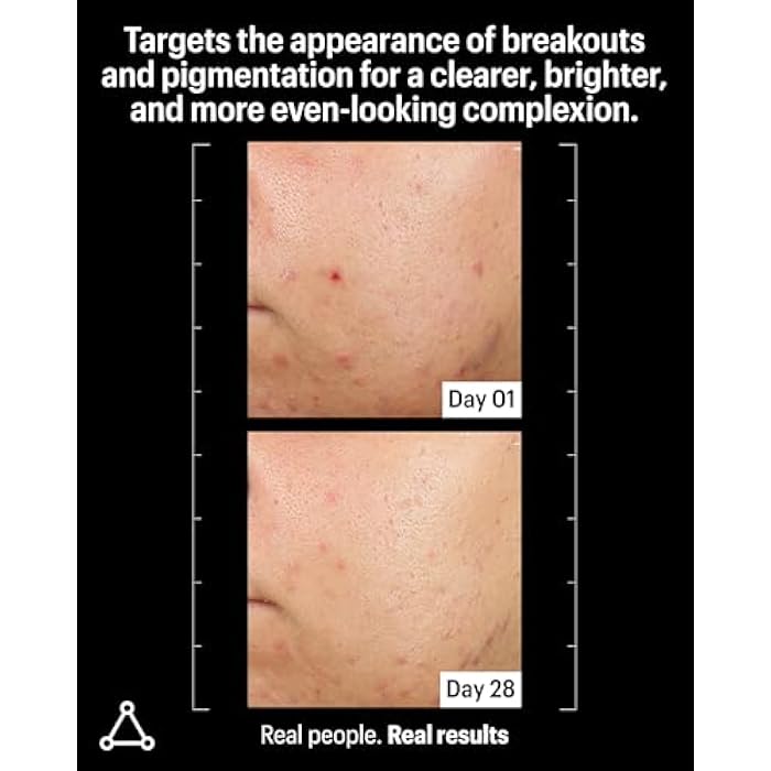 Allies of Skin Azelaic & Kojic Clarifying Face Serum | Clinically Proven for Acne & Blemish Prone Skin |10% Azelaic Acid Treats Pigmentation and Redness | Targets Pores & Uneven Skin Texture (1 Fl oz) - Image 3