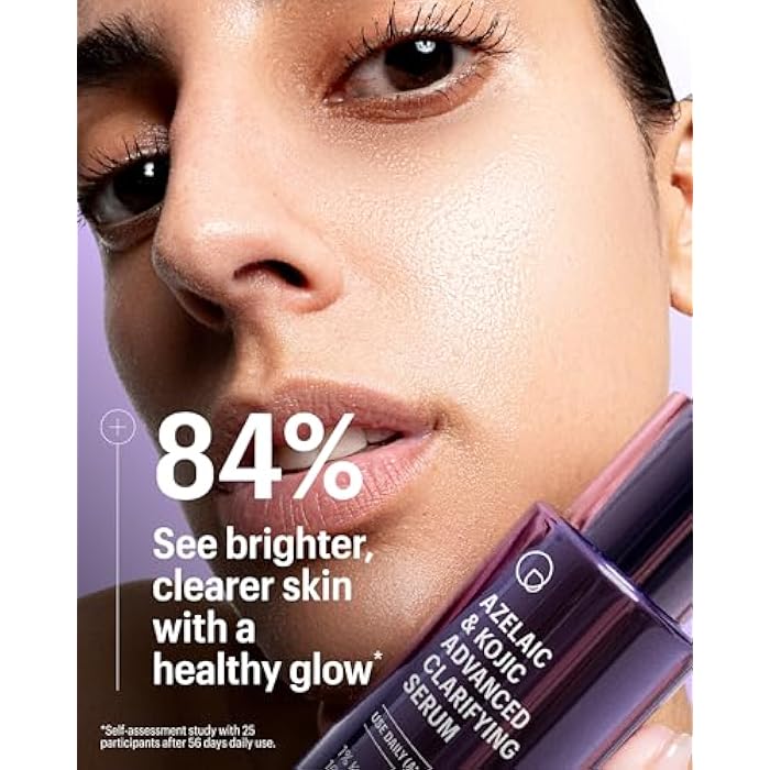 Allies of Skin Azelaic & Kojic Clarifying Face Serum | Clinically Proven for Acne & Blemish Prone Skin |10% Azelaic Acid Treats Pigmentation and Redness | Targets Pores & Uneven Skin Texture (1 Fl oz) - Image 2