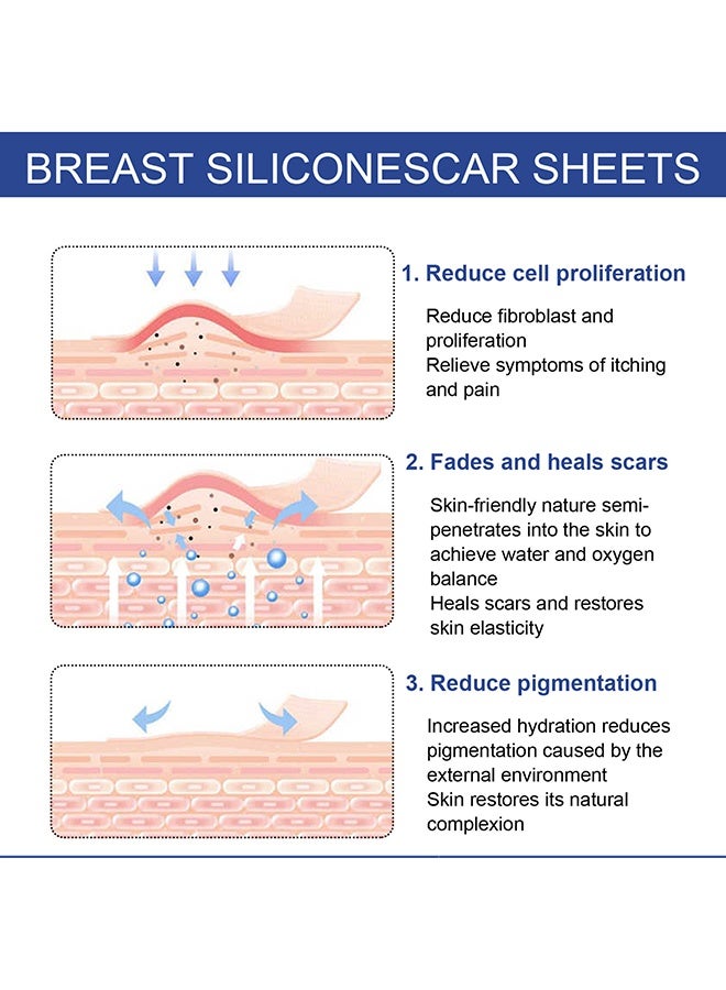 إيلهو أوراق الندوب، شريط السيليكون القابل لإعادة الاستخدام والغسيل لإزالة ندوب الجراحة، علاج ندوب الجراحة، أوراق السيليكون الطبية لإزالة الندوب - 4 أزواج - Image 5