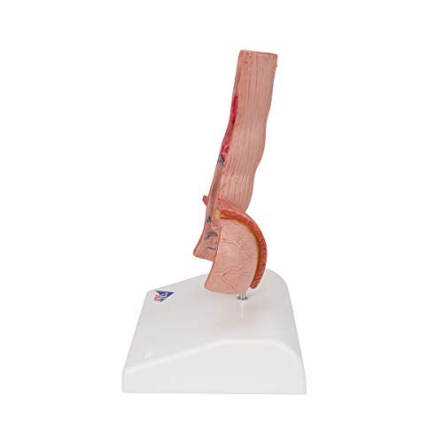 3B Scientific K18 أمراض المريء - 3B Smart Anatomy - Image 3