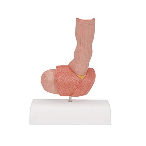 3B Scientific K18 أمراض المريء - 3B Smart Anatomy - Image 4