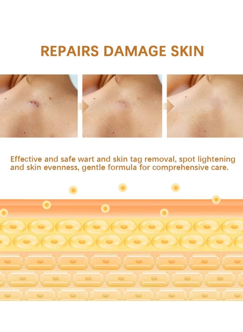 lakerain Tag Recede Bee Venom Spray Wart Treatment Spray Bee Venom Wart and Skin Tags Removal Treatment Spray Wart Remover Bee Venom Skin Tag Removal Spray Acne Removal Spray  - Image 5