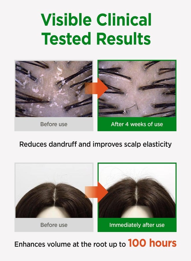 CKD Guaranteed CKD Amino Biotin All-powerful Shampoo - Daily Shampoo for Hair and Scalp, Promotes Hair Growth, Repairs Damaged Hair, Enhances Healthy Hair, and Thickens Hair. Korean Hair Care. 16.9 fl oz - Image 3