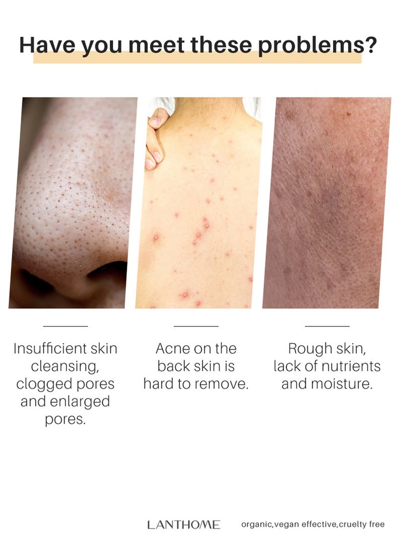 Lanthome Turmeric Soap Facial Soap Handmade Soap - Deep Skin Cleansing - Image 2