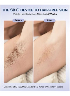SKG SKG Laser Hair Removal Device (T033MW) - IPL Technology, Customizable Settings & fast Treatments - Salon Quality Hair Removal Device  - Image 4
