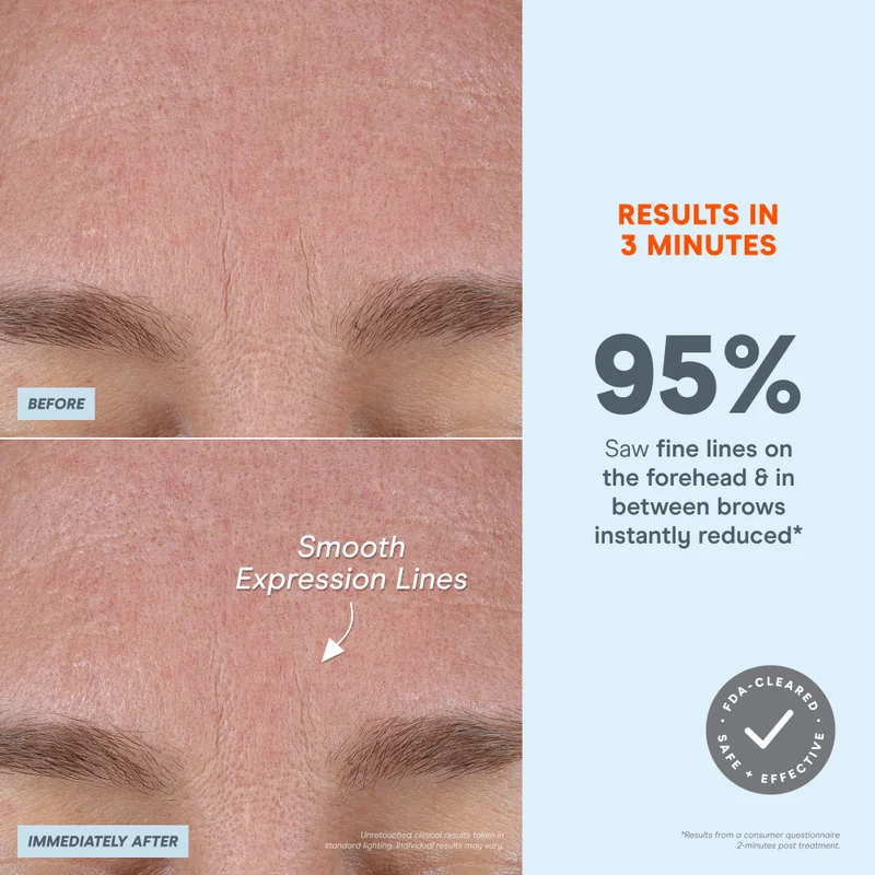 Nuface NuFACE® FIX MicroWand
